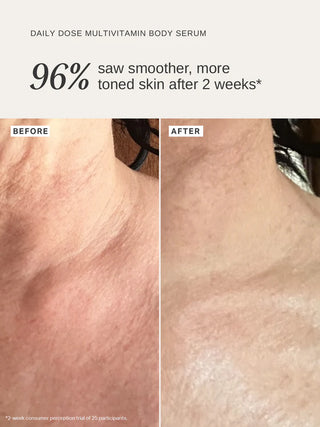 Alpha-H Daily Dose Multi-Vitamin Glow Body Serum resultaat