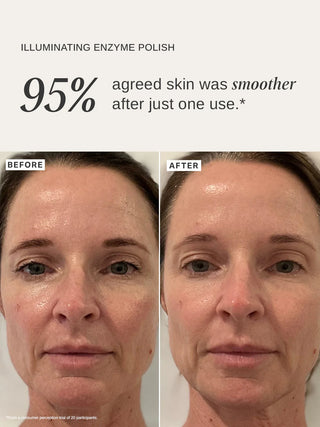 Alpha-H Illuminating Enzyme Polish before and after