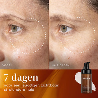 Medik8 C-Tetra Advanced 30ml resultaat
