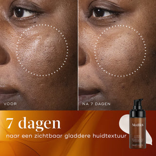 Medik8 C-Tetra Advanced 30ml resultaat