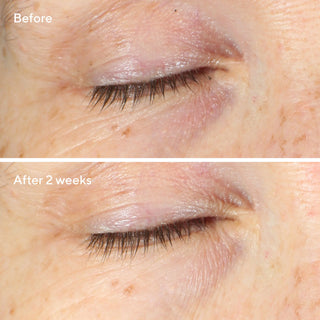 Vita-C Eyes Dark Circle Corrector 15ml | Murad