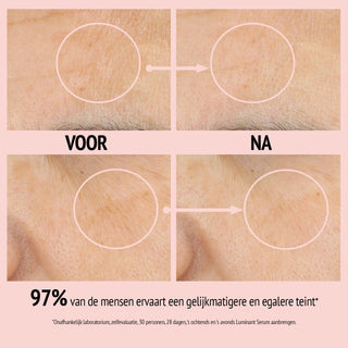 Comfort Zone Luminant Serum voor en na