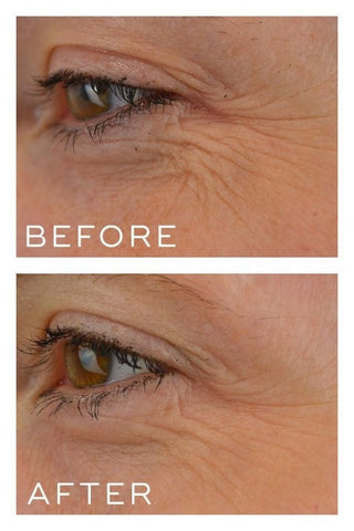 Medik8 Crystal Retinal 10 30ml effect