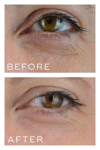 Medik8 Crystal Retinal 6 30ml effect