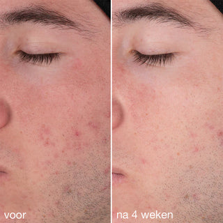 Daily Microfoliant | Dermalogica