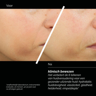 Comfort Zone Skin Regimen Lx Tripeptide Gel Cream voor en na