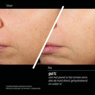 Comfort Zone Skin Regimen Lx HA4 Jelly Serum voor en na