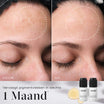 Medik8 Oxy-R Peptides 2x 10ml voor en na resultaat