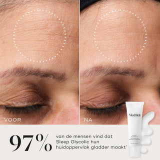 Medik8 Sleep Glycolic 30ml voor en na resultaat