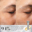 Medik8 Crystal Retinal Ceramide Eye 3 15ml voor en na resultaat