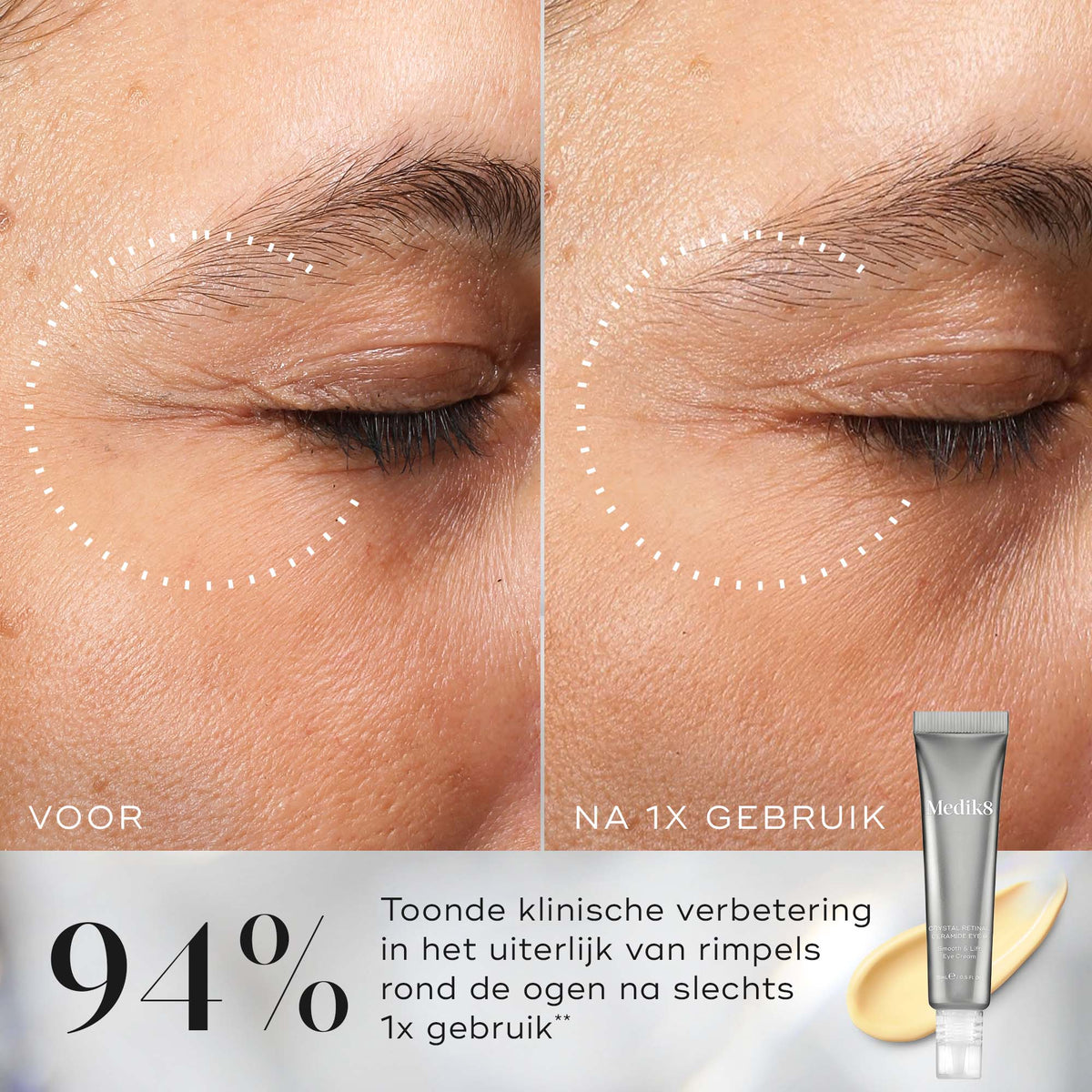 Medik8 Crystal Retinal Ceramide Eye 3 15ml voor en na resultaat