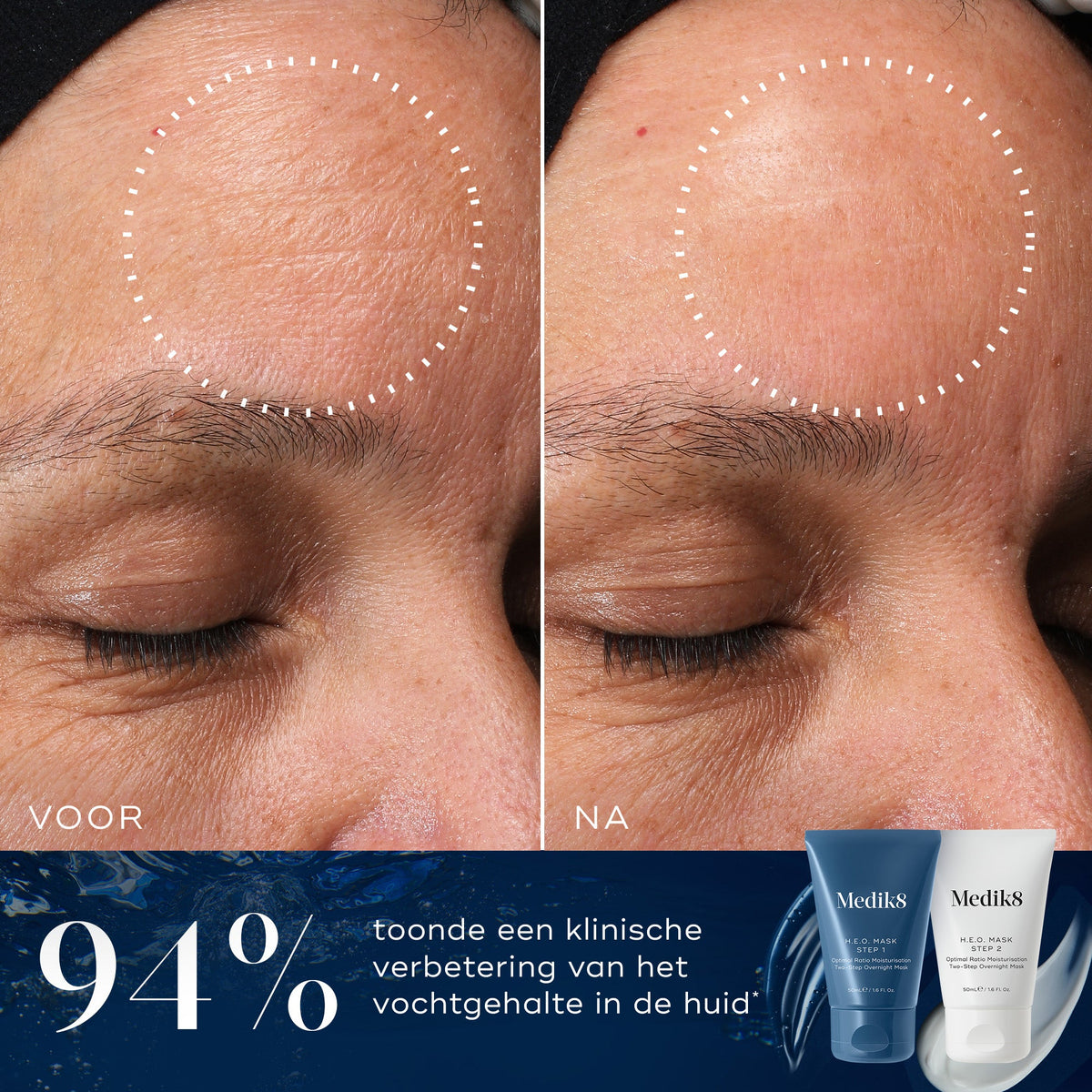 Medik8 H.E.O. Mask 2x 50ml voor en na resultaat