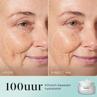 Medik8 Total Moisture Daily Facial Cream 50ml voor en na resultaat