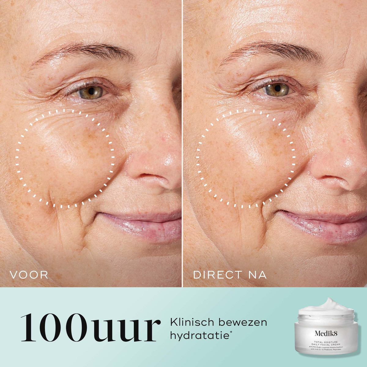 Medik8 Total Moisture Daily Facial Cream - Refill 50ml voor en na resultaat