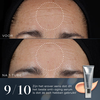 Medik8 Crystal Retinal 10 30ml voor en na resultaat twee
