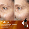 Medik8 C-Tetra Advanced 30ml voor en na resultaat