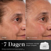 Medik8 Advanced Pro Collagen+ Peptide Cream REFILL 50ml voor en na resultaat