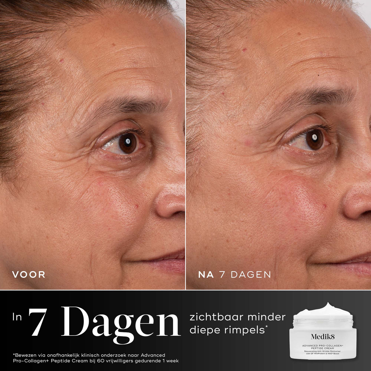 Medik8 Advanced Pro Collagen+ Peptide Cream REFILL 50ml voor en na resultaat