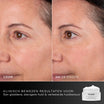 Medik8 Advanced Pro Collagen+ Peptide Cream 50ml voor en na resultaat twee