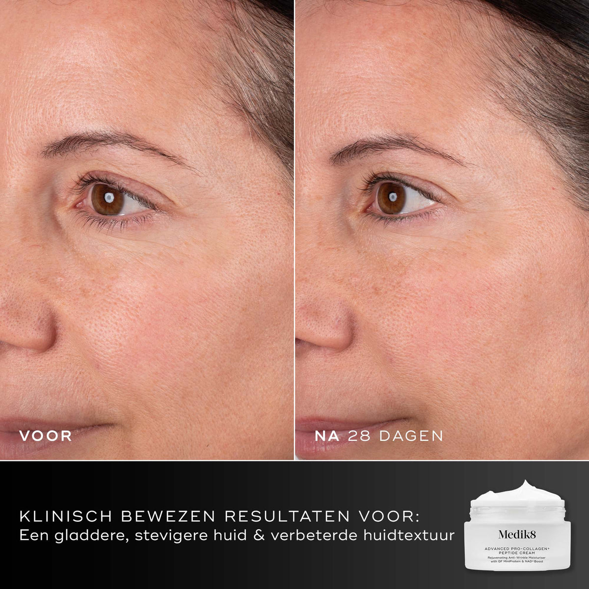 Medik8 Advanced Pro Collagen+ Refill 50ml voor en na resultaat twee