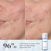 Medik8 Press & Clear Refill 150ml voor en na resultaat