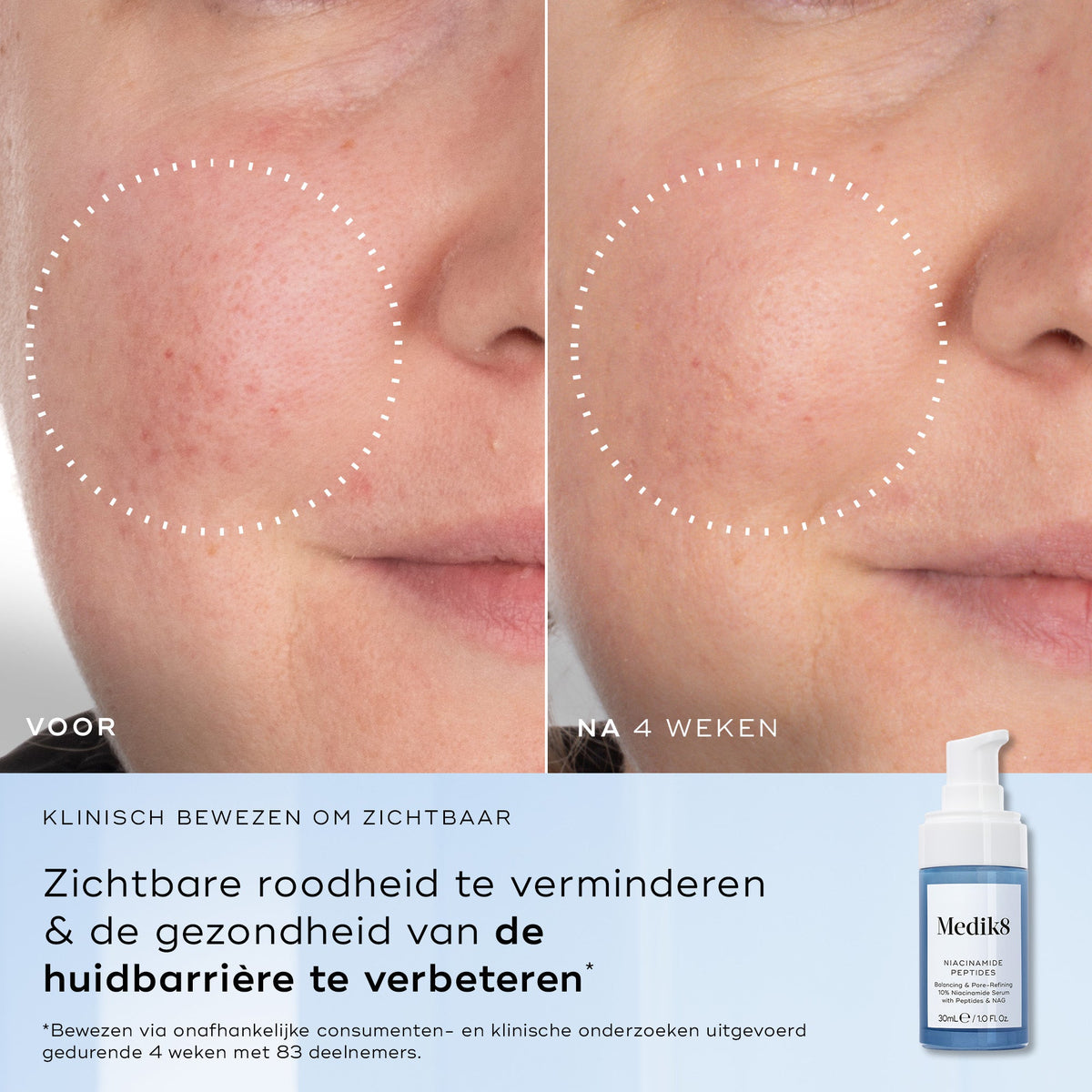 Medik8 Niacinamide peptides 30ml voor en na resultaat
