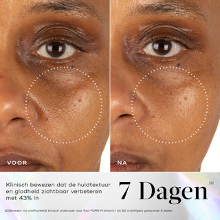Medik8 Exo-PDRN Prismatic+ 30ml voor en na resultaat drie