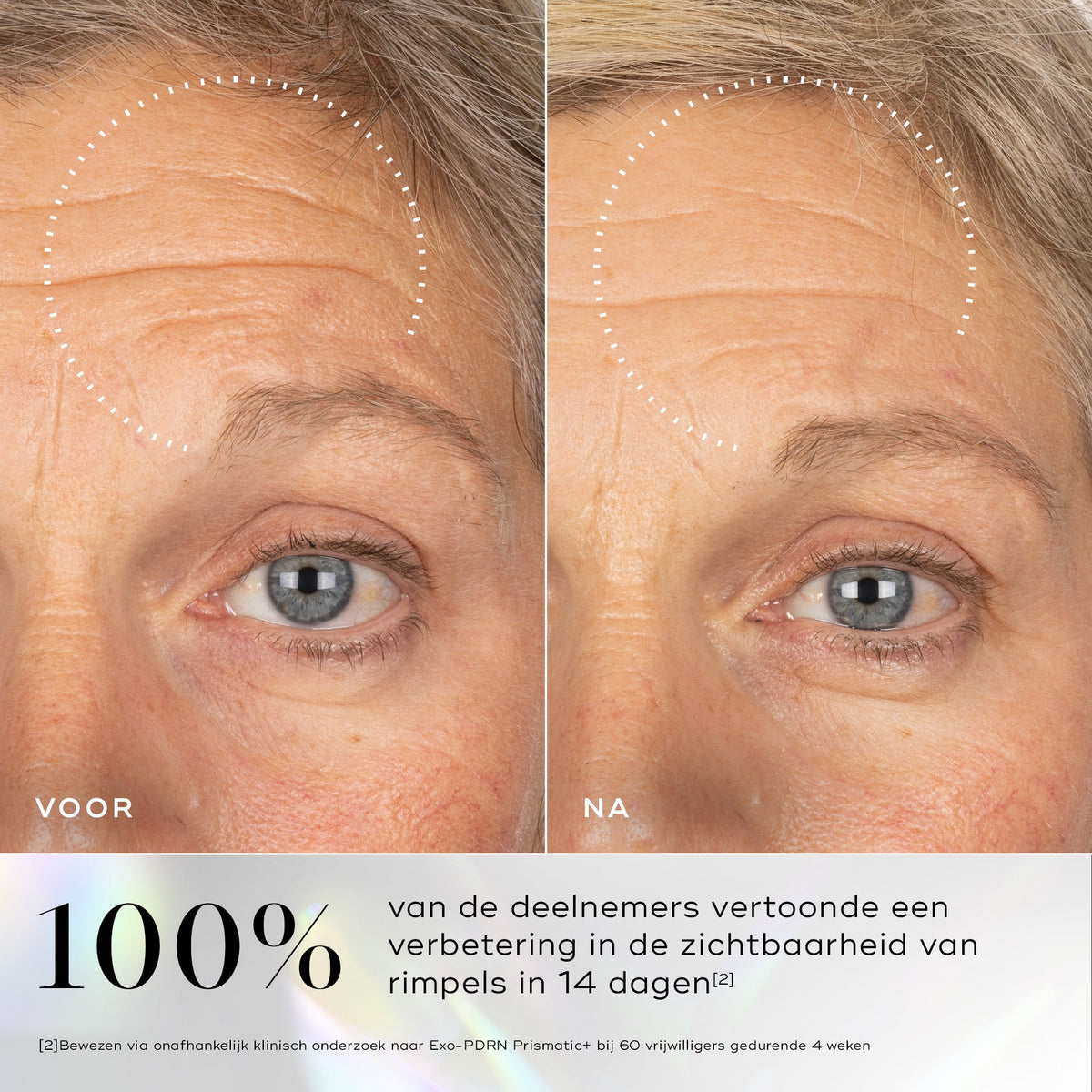 Medik8 Exo-PDRN Prismatic+ 30ml voor en na resultaat