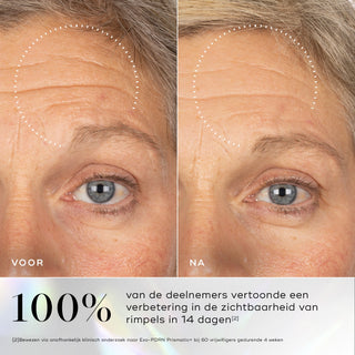 Medik8 Exo-PDRN Prismatic+ 30ml voor en na resultaat