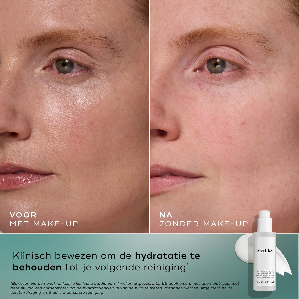 Medik8 Total Moisture Cleansing Gel 145ml voor en na resultaat