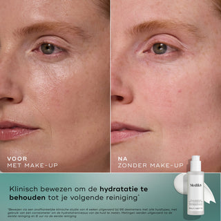 Medik8 Total Moisture Cleansing Gel 145ml voor en na resultaat