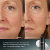 Medik8 Liquid Peptides Advanced MP 30ml voor en na resultaat twee