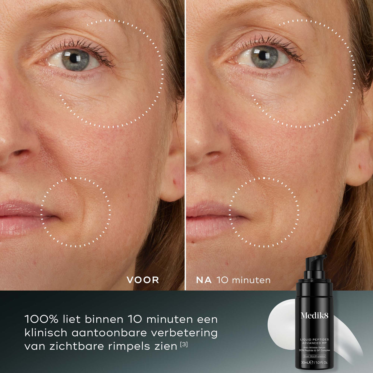 Medik8 Liquid Peptides Advanced MP 30ml voor en na resultaat twee