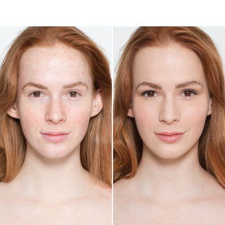 Delilah Alibi Foundation Lily before and after