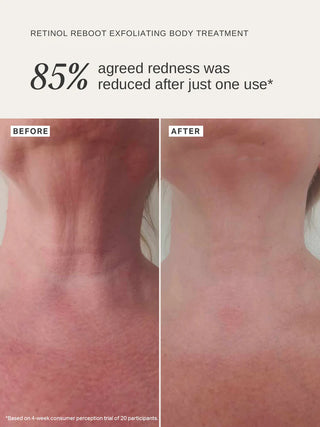 Retinol Reboot Exfoliating Body Treatment 120ml