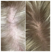 Calecim Advanced Hair System Kit 6 x ml result