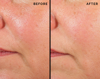 Comfort Zone Skin Regimen Lx Longevity Collagen Serum before en after