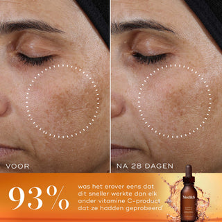 Medik8 Super C Ferulic 30ml voor en na resultaat