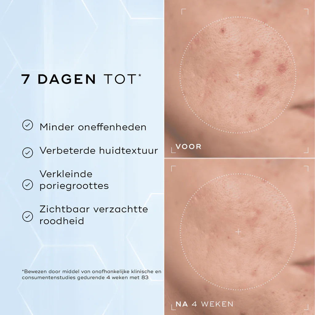 Medik8 Niacinamide peptides 30ml voor en na 4 weken