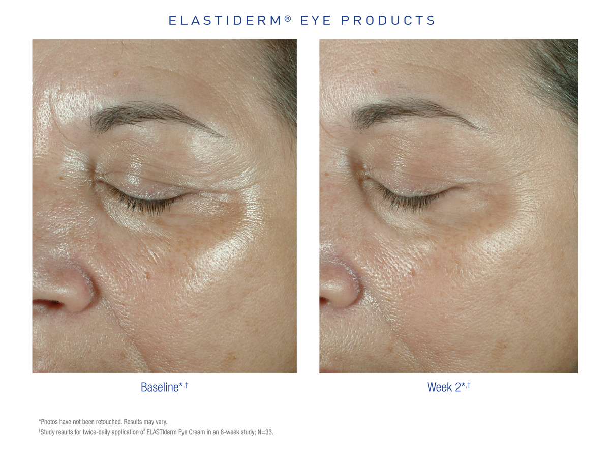 Obagi Elastiderm Eye Cream sfeer