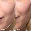 Grown Alchemist Skin Renewal Serum voor en na