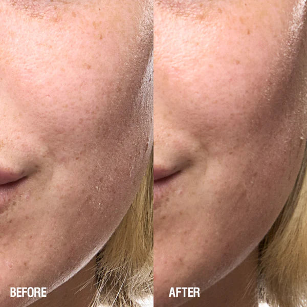 Grown Alchemist Skin Renewal Serum voor en na