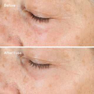Vita-C Triple Exfoiliating Facial 80ml