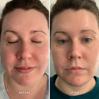 Vitamin A Serum 25ml | Alpha-H