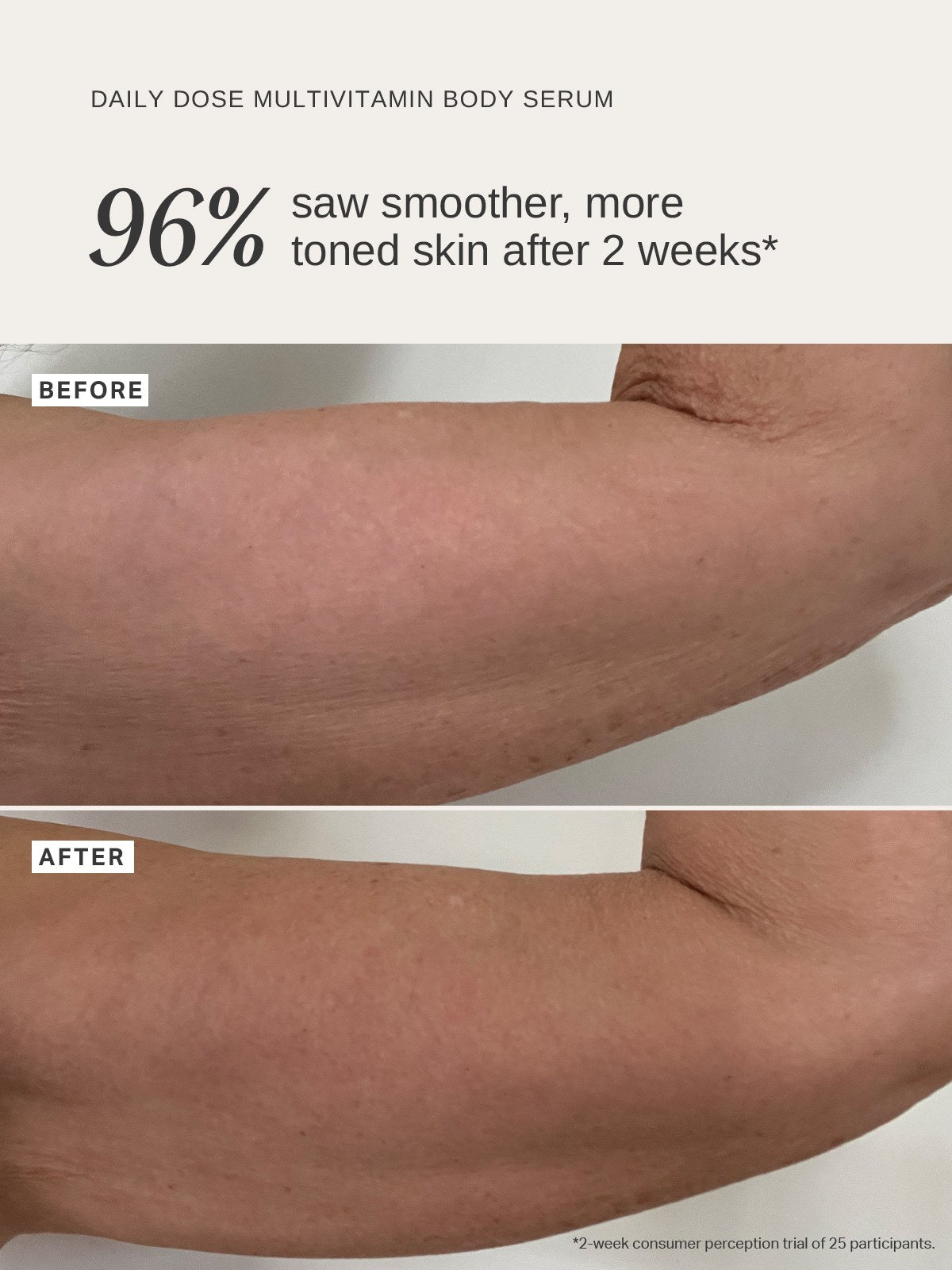 Alpha-H Daily Dose Multi-Vitamin Glow Body Serum voor en na arm