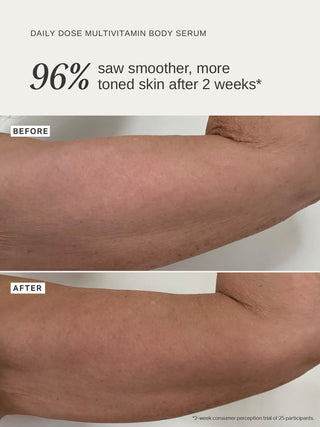 Alpha-H Daily Dose Multi-Vitamin Glow Body Serum voor en na arm