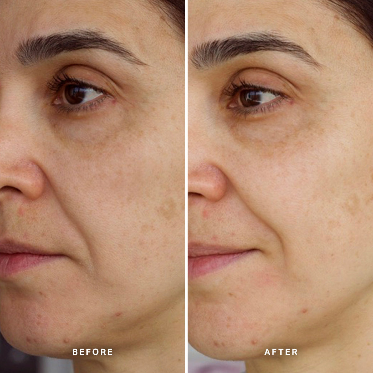 Alpha-H High Tide Water Cream voor en na resultaat twee
