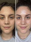 Alpha-H Liquid Gold Exfoliating Treatment voor en na resultaat twee