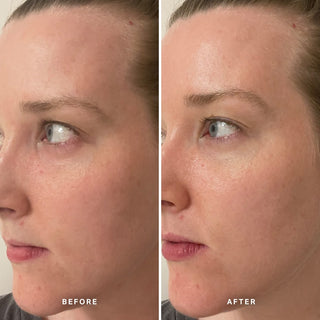 Alpha-H Midnight Reboot Serum voor en na resultaat vier