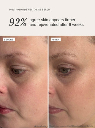 Alpha-H Multi-Peptide Revitalise Serum voor en na resultaat drie